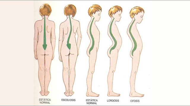 Centro de Rehabilitación y Corrección Postural en la Guia Esquel
