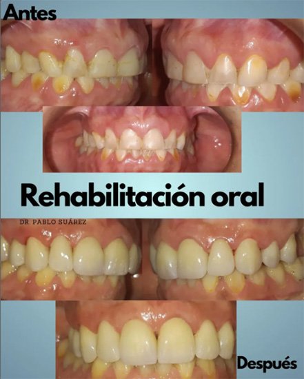 Odontologo Pablo Suarez