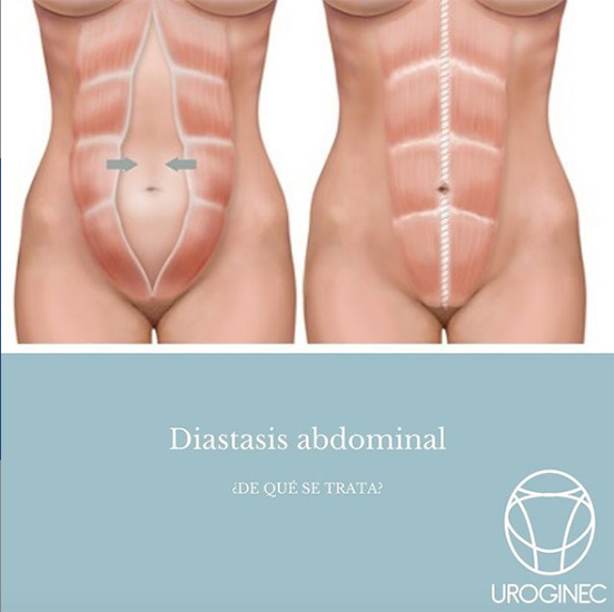 Uroginec Uroginecologia en La Guia Esquel
