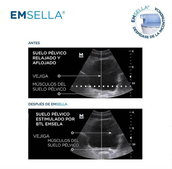 Uroginec Uroginecologia en La Guia Esquel