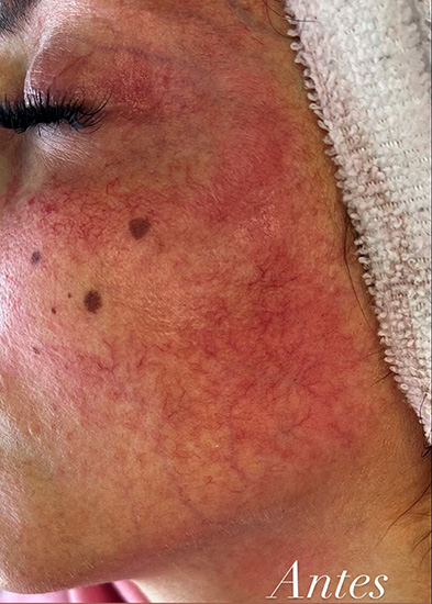 Body Skin Cosmetología y Cosmiatría en La Guia Esquel