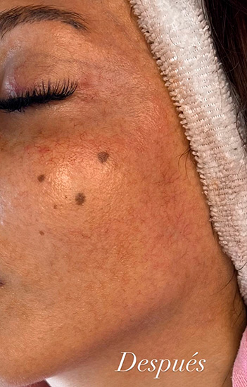 Body Skin Cosmetología y Cosmiatría en La Guia Esquel