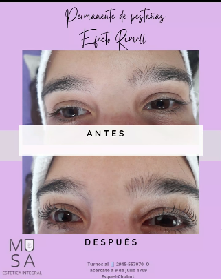Musa_estética_en_La_Guia_Esquel