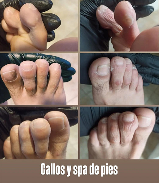 Ya_estetica_integral_en_La_Guia_Esquel